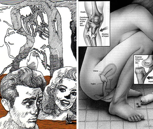 Ballardian: The Atrocity Exhibition
